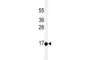 THEM2 antibody western blot analysis in HeLa lysate. (THEM2 antibody)