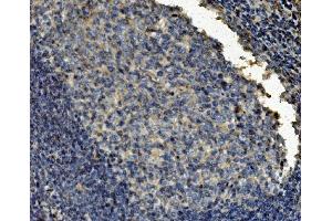 IHC analysis of Clathrin heavy chain/CLTC using anti-Clathrin heavy chain/CLTC antibody (ABIN7602703). (Clathrin Heavy Chain (CLTC) (AA 967-1668) antibody)