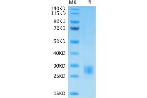 Biotinylated Human CTLA4 on Tris-Bis PAGE under reduced condition. (CTLA4 Protein (His-Avi Tag,Biotin))