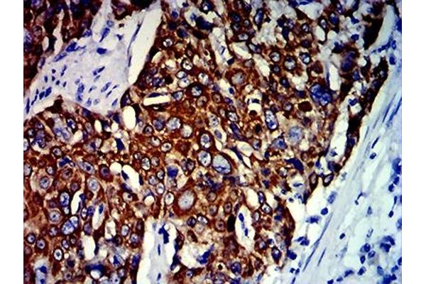 Cytokeratin 13 antibody  (AA 104-458)
