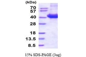 SDS-PAGE (SDS) image for CD46 (CD46) (AA 35-313) protein (His tag) (ABIN5854715) (CD46 Protein (CD46) (AA 35-313) (His tag))