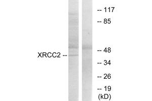 Western blot analysis of extracts from 293cells, using XRCC2 antibody. (XRCC2 antibody  (C-Term))