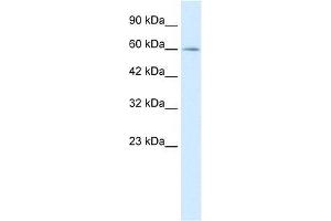 Human Jurkat; WB Suggested Anti-MYEF2 Antibody Titration: 0. (MYEF2 antibody  (Middle Region))