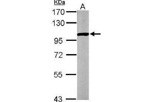 PYGB anticorps  (C-Term)