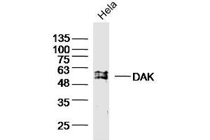 HeLa cell lysates probed with DAK Polyclonal Antibody, unconjugated (bs-20314R) at 1:300 overnight at 4°C followed by a conjugated secondary antibody for 60 minutes at 37°C. (DAK antibody  (AA 101-200))