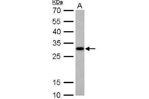WB Image CTDSP2 antibody detects CTDSP2 protein by Western blot analysis. (CTDSP2 antibody  (Center))