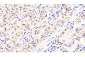 Detection of GT in Human Stomach Tissue using Polyclonal Antibody to Gastrin (GT) (Gastrin antibody  (AA 1-101))