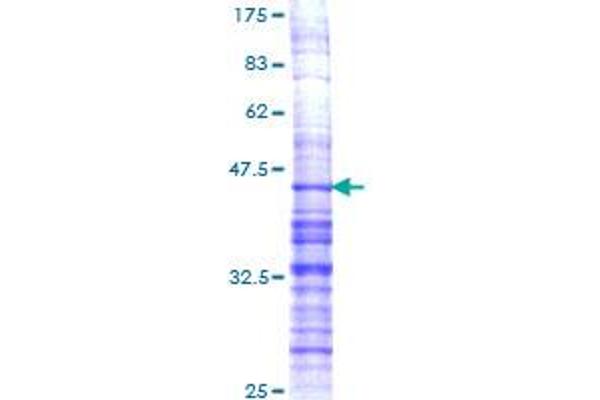 PDYN Protein (AA 147-254) (GST tag)