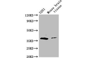 Western Blot Positive WB detected in: Mouse brain tissue All lanes: ADORA2B antibody at 3 μg/mL Secondary Goat polyclonal to rabbit IgG at 1/50000 dilution Predicted band size: 37 kDa Observed band size: 37 kDa (Adenosine A2b Receptor antibody  (AA 292-332))