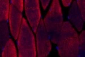 Immunofluorescence (fixed cells) (IF/ICC) image for anti-alpha-Actinin Skeletal Muscle (ACTN) antibody (ABIN7073023)