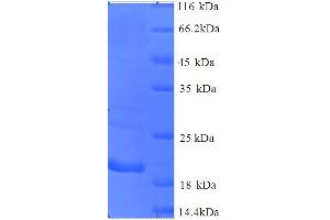 CTAG1B Protein (AA 1-180, full length) (His tag)