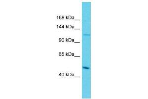 Host:  Rabbit  Target Name:  Atf7ip  Sample Type:  Mouse Lung lysates  Antibody Dilution:  1. (MCAF1 antibody  (Middle Region))