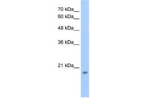 WB Suggested Anti-DNTTIP1 Antibody Titration:  2.