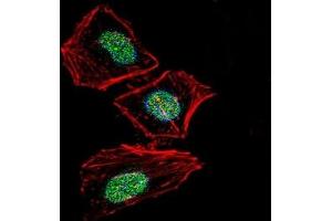 Immunofluorescence (IF) image for anti-X-Ray Repair Complementing Defective Repair in Chinese Hamster Cells 6 (XRCC6) (AA 521-548) antibody (ABIN3029655)