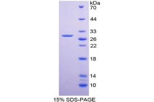 SDS-PAGE of Protein Standard from the Kit (Highly purified E. (PDGFRA ELISA Kit)