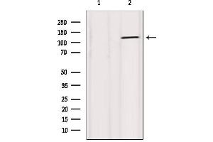 Western Blotting (WB) image for anti-Sodium Potassium ATPase, alpha1 (ATP1A1) (N-Term) antibody (ABIN6260140)