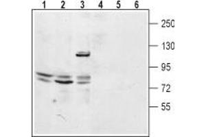 Western blot analysis of mouse kidney lysate (lanes 1 and 4), rat lung membrane (lanes 2 and 5) and human embryonic Kidney 293 cell lysate (lanes 3 and 6): - 1-3. (TPCN2 antibody  (2nd Lumenal Region))