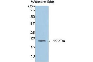 Western Blotting (WB) image for anti-Adrenomedullin (ADM) (AA 24-171) antibody (ABIN1857923) (Adrenomedullin antibody  (AA 24-171))