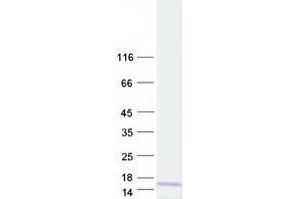 TOMM6 Protein (Myc-DYKDDDDK Tag)