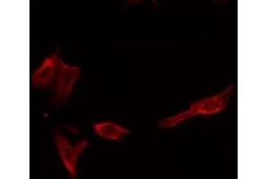 ABIN6266589 staining HepG2 by IF/ICC. (MMP1 antibody  (C-Term))