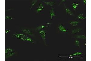 Immunofluorescence of purified MaxPab antibody to IMPDH2 on HeLa cell. (IMPDH2 antibody  (AA 1-514))