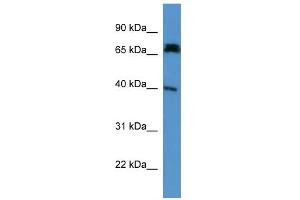 WB Suggested Anti-Dcdc2a Antibody Titration: 0. (DCDC2 antibody  (N-Term))