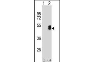 Western blot analysis of LMX1B (arrow) using rabbit polyclonal LMX1B Antibody (Center) (ABIN652882 and ABIN2842570). (LMX1B antibody  (AA 175-202))