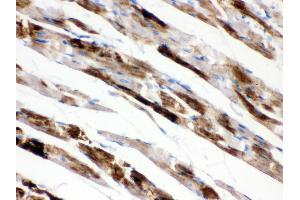 Anti- MAOA Picoband antibody,IHC(P) IHC(P): Rat Cardiac Muscle Tissue (Monoamine Oxidase A antibody  (C-Term))