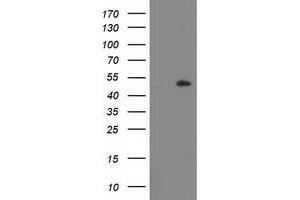 HEK293T cells were transfected with the pCMV6-ENTRY control (Left lane) or pCMV6-ENTRY LPL (Right lane) cDNA for 48 hrs and lysed. (Lipoprotein Lipase antibody)