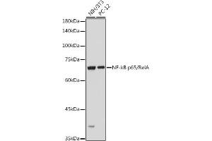Western blot analysis of extracts of various cell lines, using NF-kB p65/RelA antibody (ABIN6131885, ABIN6146861, ABIN6146863 and ABIN6215108) at 1:1000 dilution. (NF-kB p65 antibody  (AA 1-200))