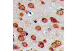 Immunohistochemical analysis of DHAPAT staining in human brain formalin fixed paraffin embedded tissue section. (GNPAT antibody  (Center))