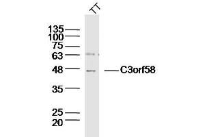 Human TT lysates probed with C3orf58 Polyclonal Antibody, Unconjugated  at 1:300 dilution and 4˚C overnight incubation. (C3orf58 antibody  (AA 351-430))