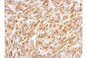 IHC-P Image Prohibitin 2 antibody detects PHB2 protein at cytosol on U87 xenograft by immunohistochemical analysis. (Prohibitin 2 antibody)