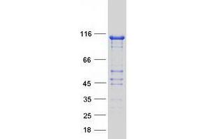 Validation with Western Blot (C14orf102 Protein (Transcript Variant 2) (Myc-DYKDDDDK Tag))