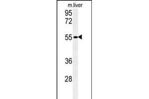anti-Family with Sequence Similarity 151, Member A (FAM151A) (AA 547-576), (C-Term) antibody