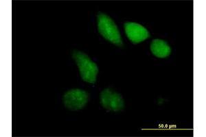 Immunofluorescence of purified MaxPab antibody to MBD1 on HeLa cell. (MBD1 antibody  (AA 1-605))