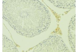 ABIN6277084 at 1/100 staining Mouse testis tissue by IHC-P. (Osteoprotegerin antibody  (Internal Region))