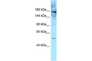 WB Suggested Anti-FYCO1 Antibody Titration: 1. (FYCO1 antibody  (N-Term))