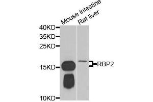 Western blot analysis of extracts of various cell lines, using RBP2 antibody (ABIN5974059) at 1/1000 dilution. (RBP2 antibody)