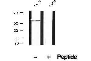 Western blot analysis of extracts of HepG2 cells, using SHMT1 antibody. (SHMT1 antibody  (Internal Region))