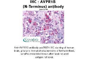 Image no. 1 for anti-Arginine Vasopressin Receptor 1B (AVPR1B) (Extracellular Domain), (N-Term) antibody (ABIN1732152) (AVPR1B antibody  (Extracellular Domain, N-Term))