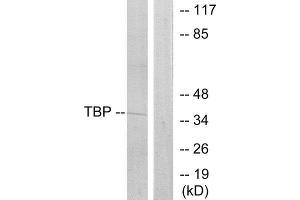 Western Blotting (WB) image for anti-TATA Box Binding Protein (TBP) (Internal Region) antibody (ABIN1849233) (TBP antibody  (Internal Region))