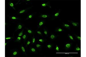 Immunofluorescence of monoclonal antibody to RPS2 on HeLa cell.