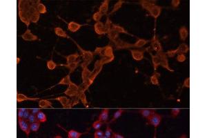 Immunofluorescence analysis of NIH/3T3 cells using ABCB11 Polyclonal Antibody at dilution of 1:100. (ABCB11 antibody)
