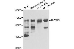 Western blot analysis of extracts of various cell lines, using ALOX15 antibody.