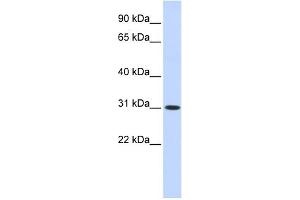 WB Suggested Anti-CYB5D2 Antibody Titration: 0. (CYB5D2 antibody  (N-Term))