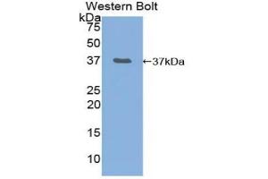 Detection of Recombinant NF2, Mouse using Polyclonal Antibody to Neurofibromin 2 (NF2) (Merlin antibody  (AA 30-311))