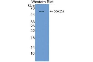 Western blot analysis of the recombinant protein. (CPT1A antibody  (AA 572-773))