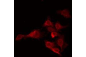 OR5H15 antibody  (C-Term)