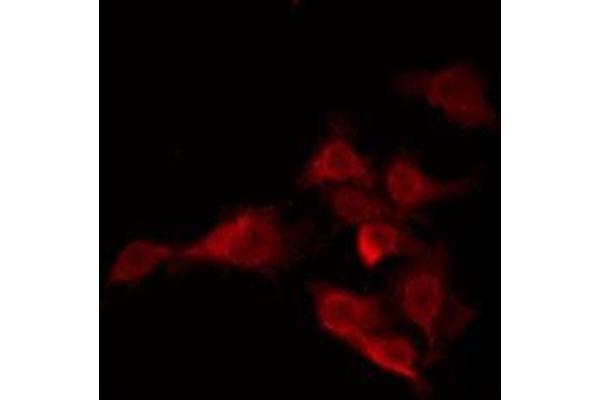 OR5H15 antibody  (C-Term)
